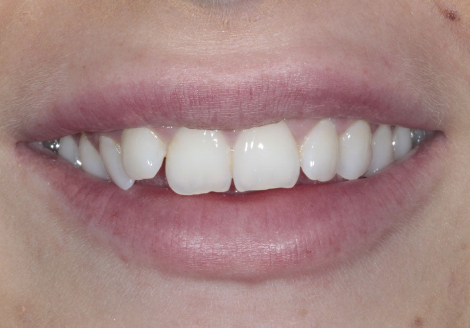 Before